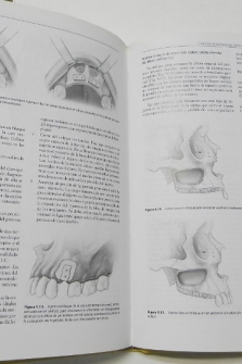 Cirugía oral e implantología